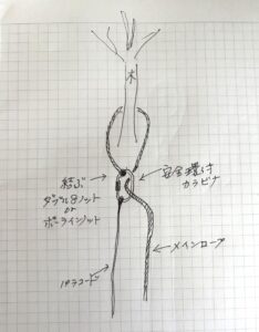 ロープ回収方法